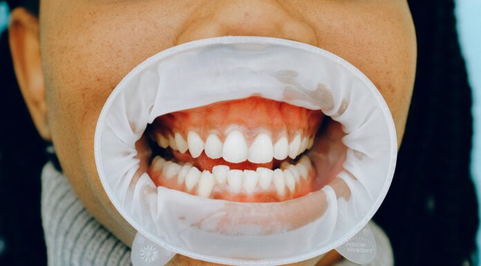 Bleeding Gums: What It Says About Your Health? Gums Healthy