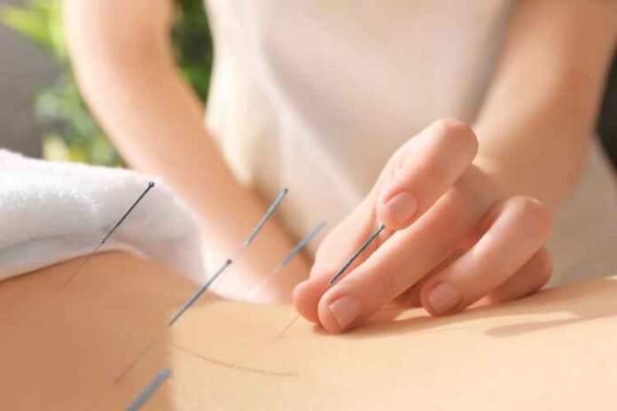 How To Escape The Risks Of Acupuncture Treatments Safely - The Dos And Don’ts