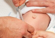 Adult Circumcision– Post Surgery Questions And Answers! Adult Circumcision– Post Surgery Questions And Answers