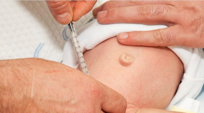 Adult Circumcision– Post Surgery Questions And Answers! Adult Circumcision– Post Surgery Questions And Answers